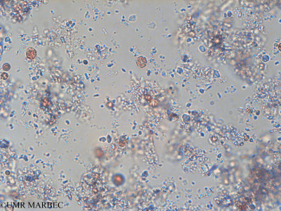 phyto/Pertuis Charentais/Tasdon_st2/PAMPAS 2019-2021/Crucigenia tetrapedia (TASDON_St2_140319-061).tif(copy)_thumb.jpg